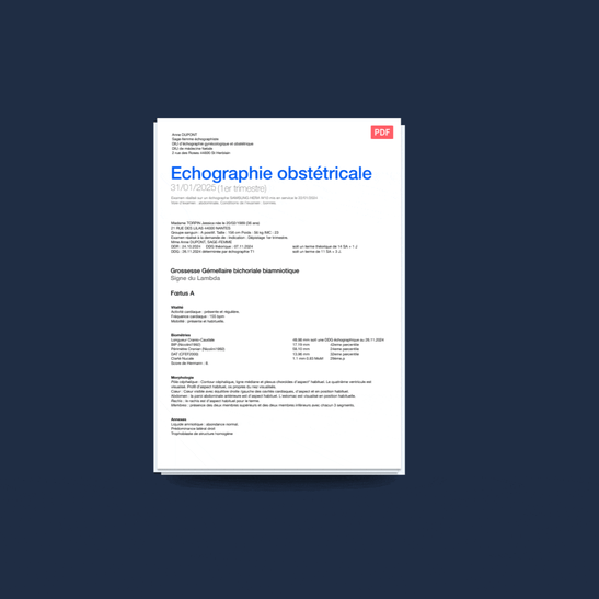 Echographie obstetricale
